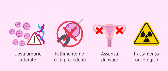 Imagen: Indicazioni per la FIVET con Ovodonazione