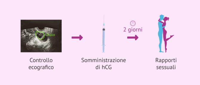 Imagen: Protocollo di rapporti mirati con induzione dell'ovulazione