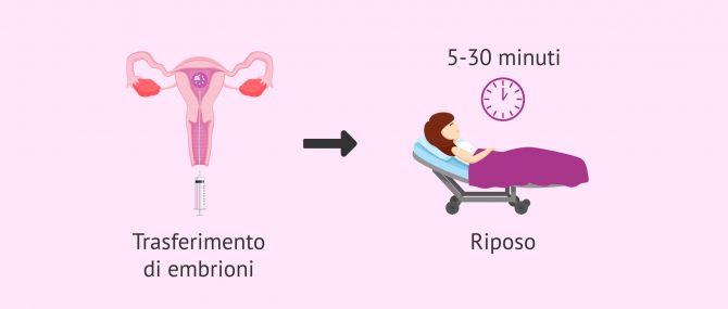 Imagen: Riposo dopo l'ICSI