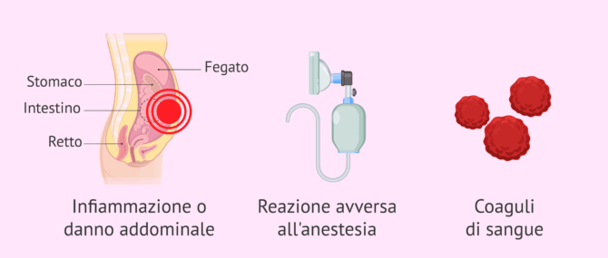 Imagen: Rischi associati alla laparoscopia