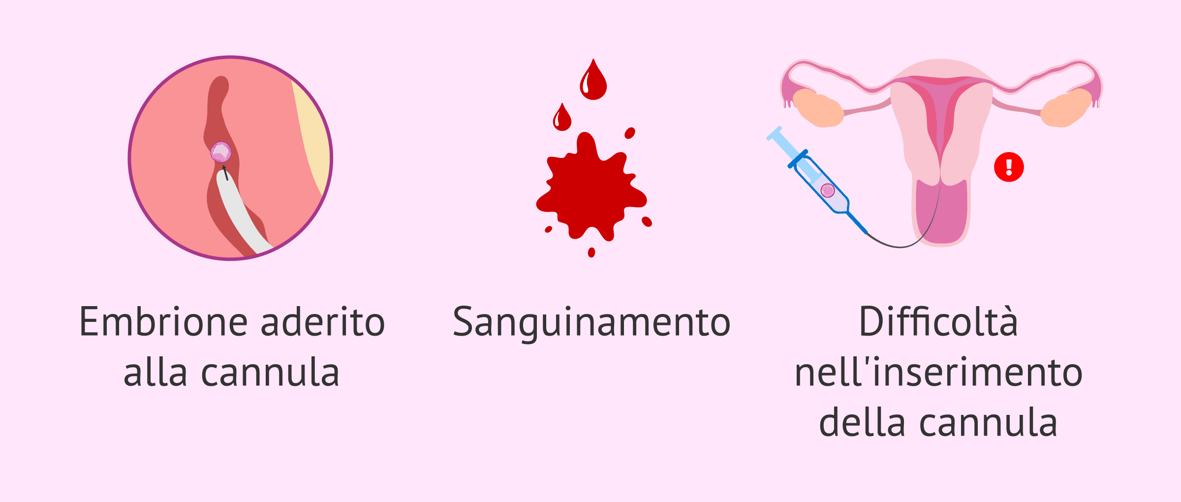 Quali sono i rischi della gravidanza tramite ovodonazione?