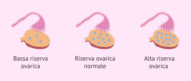 Imagen: Risultati dopo la conta dei follicoli antrali