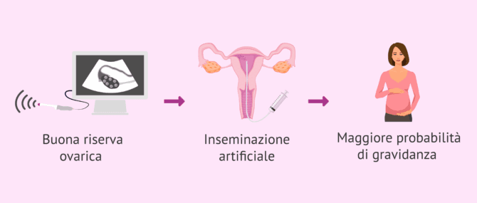 Imagen: Riserva ovarica e gravidanza tramite inseminazione artificiale