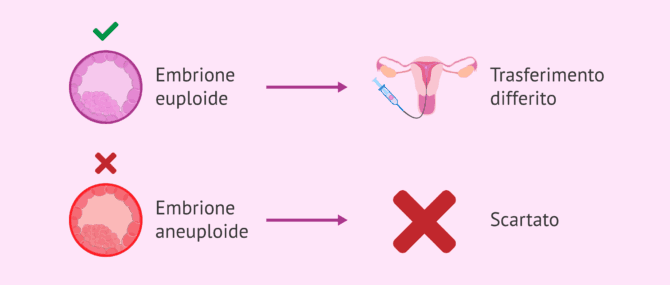 Imagen: Risultati dopo la biopsia embrionale