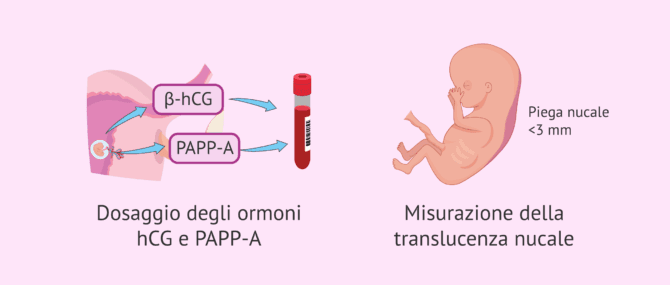 Imagen: Esami medici nella 10ª settimana di gravidanza