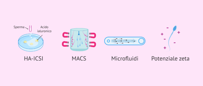 Imagen: Tecniche avanzate di selezione spermatica