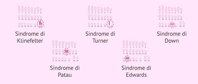 Imagen: Alterazioni cromosomiche numeriche