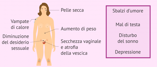 Imagen: Sintomi della menopausa precoce