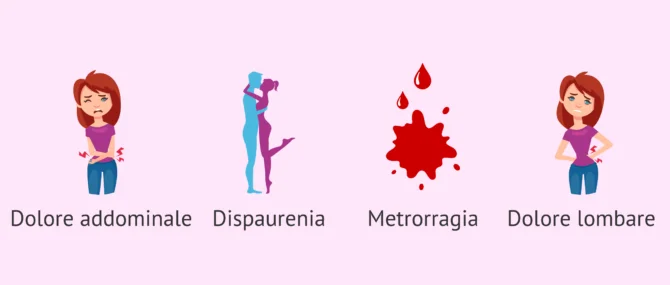 Imagen: Sintomi dell'endometriosi