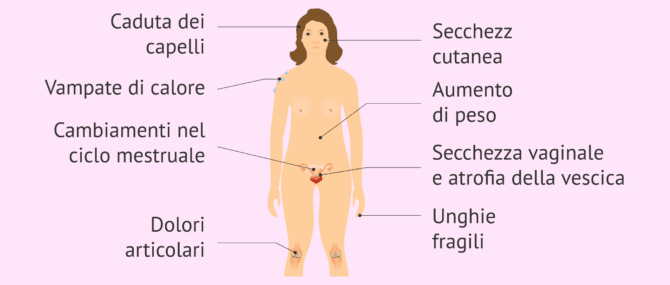 Imagen: Sintomi nel climaterio e nella menopausa