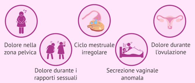 Imagen: Sintomi della salpingite