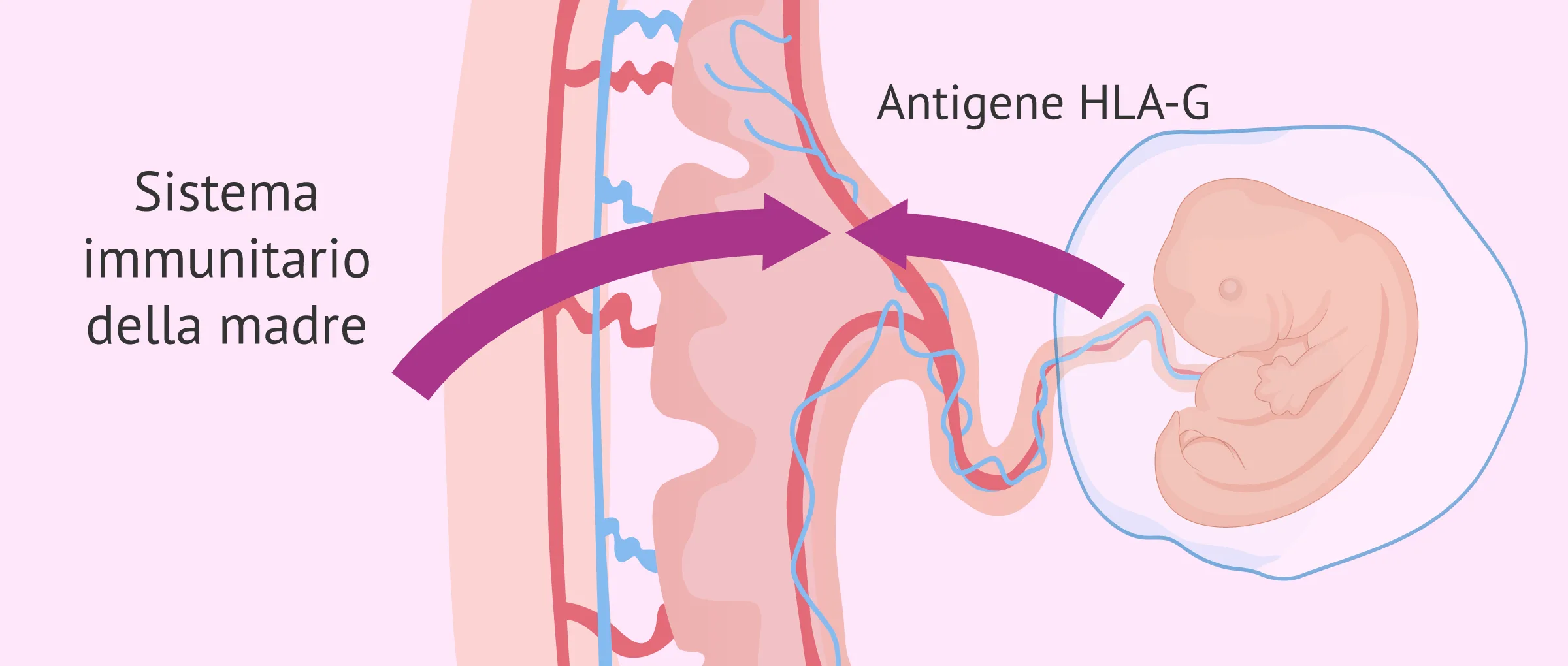 Infertilità immunologica: tipi, cause e trattamenti