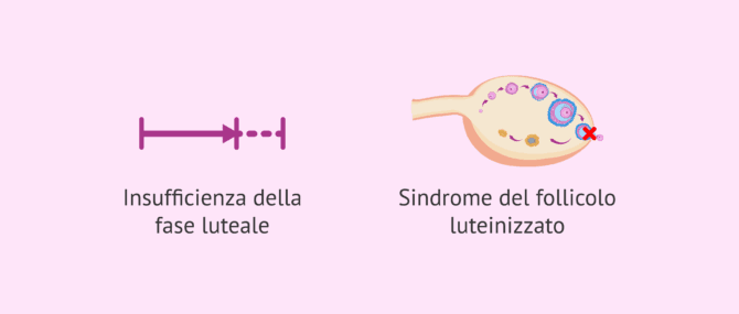 Imagen: Alterazioni correlate alla fase luteale