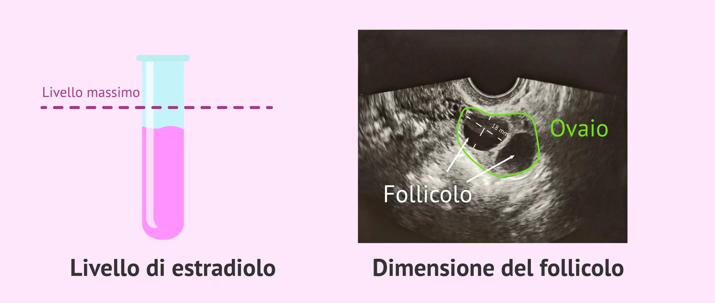 Monitoraggio e controllo della stimolazione ovarica