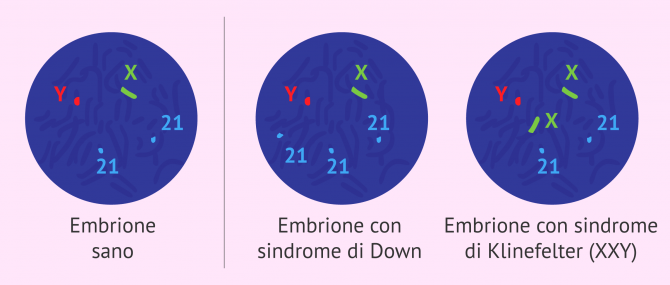 Imagen: Analisi cromosomica FISH