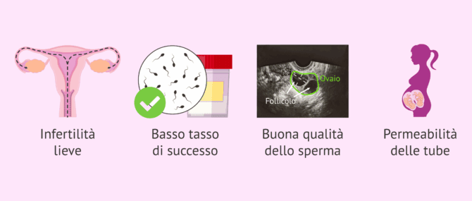 Imagen: Indicazioni e svantaggi dei rapporti mirati