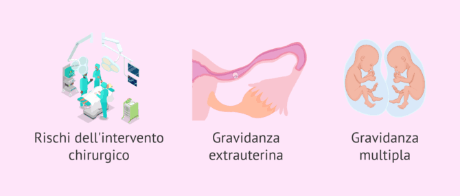 Imagen: Svantaggi del trasferimento intratubarico di zigoti
