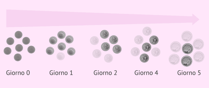 Imagen: Solo gli embrioni di buona qualità raggiungono lo stadio di blastocisti