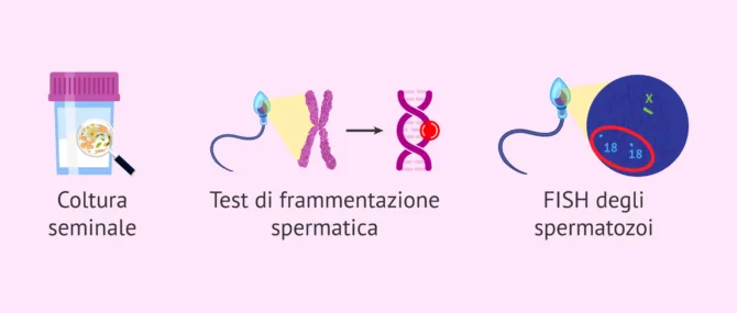 liquido seminale esame morfologico e indice di fertilità milano Gli esami base in seminologia