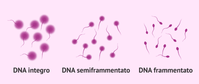 Imagen: Test di dispersione della cromatina spermatica