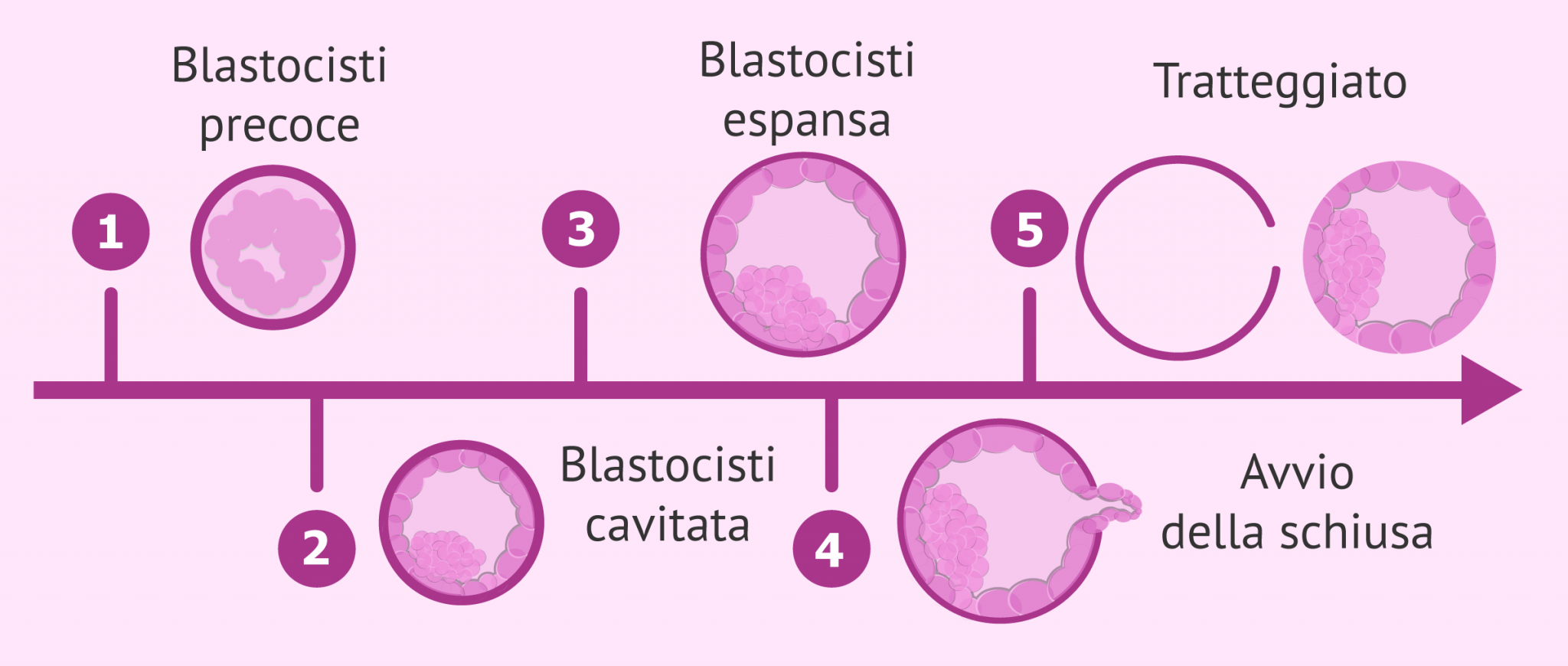 Blastocisti Espansa Di Un Percorso Di Pma