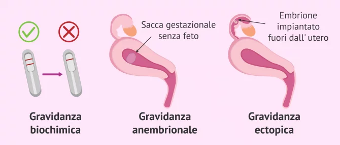 La gravidanza: sintomi, cura e fasi dello sviluppo fetale