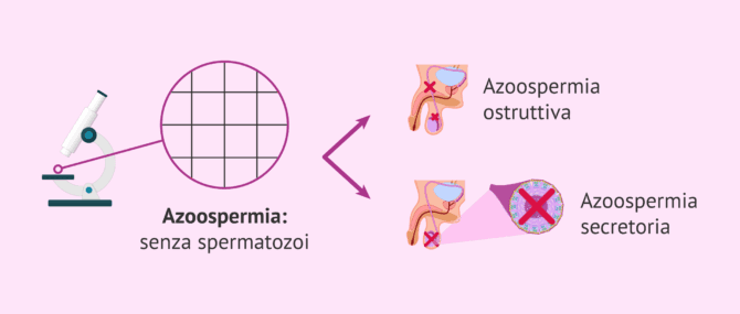 Imagen: Quali sono i tipi di azoospermia?