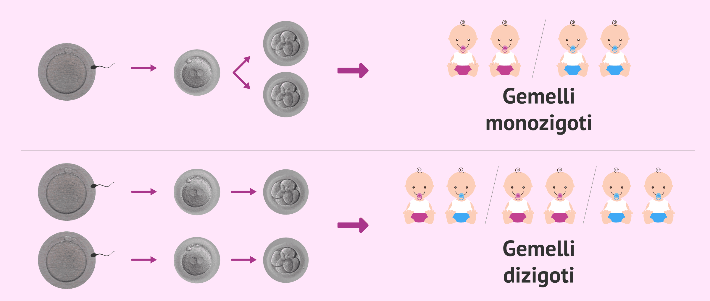 Qual è la differenza tra una gravidanza gemellare e una gravidanza di gemelli?