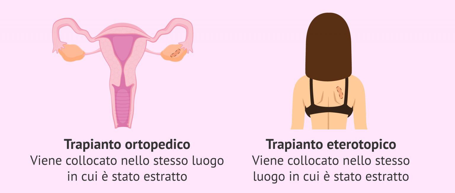 Se Mi Viene Il Ciclo Posso Essere Incinta