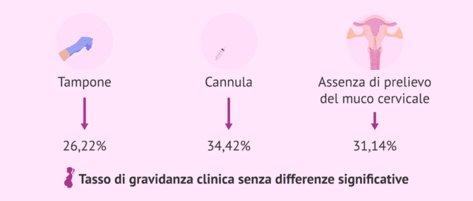 Imagen: Effetto della rimozione del muco cervicale sul tasso di successo dell'ICSI