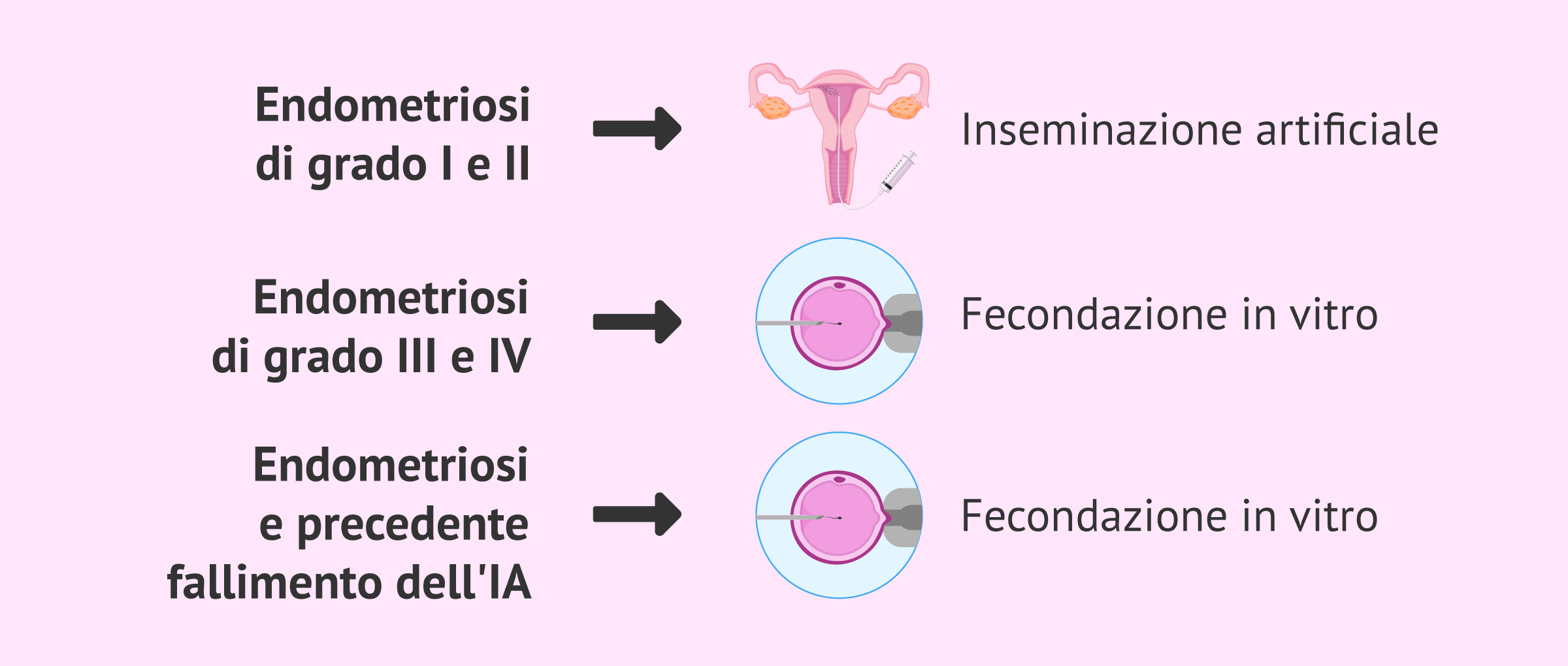 Endometriosi e trattamenti per la fertilità