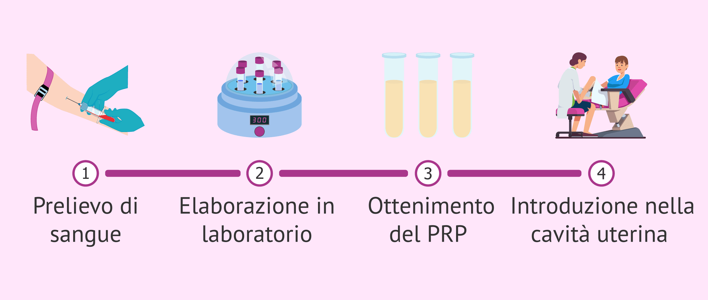 Il plasma ricco di piastrine (PRP) migliora il successo nella riproduzione assistita