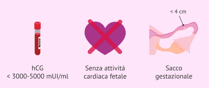 Imagen: Trattamento medico della gravidanza ectopica