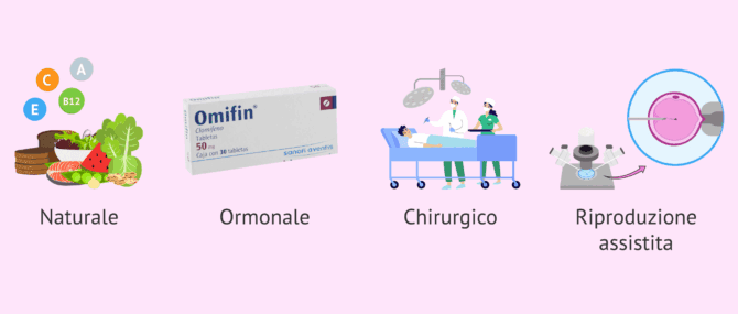 Imagen: Trattamenti per la sterilità maschile