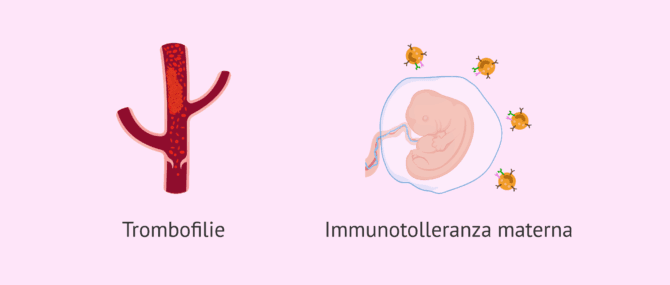 Imagen: Studio delle trombofilie e immunologico nei fallimenti di impianto