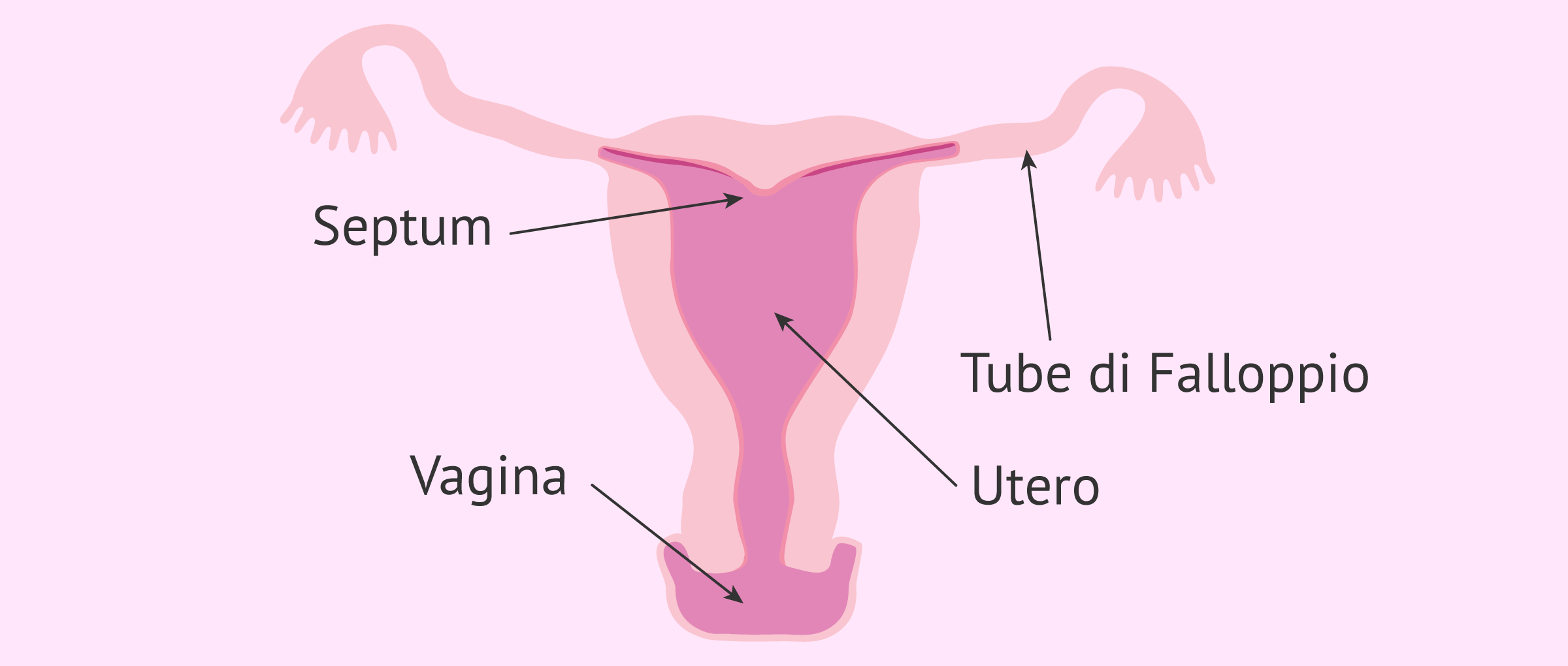 L'utero arcuato
