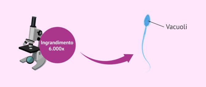 Imagen: Vacuoli nella testa dello spermatozoo