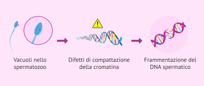 Imagen: Cosa può implicare che uno spermatozoo abbia dei vacuoli?