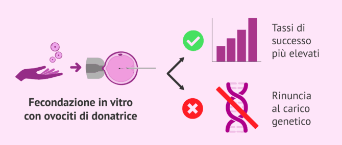 Imagen: Vantaggi e svantaggi dell'ovodonazione