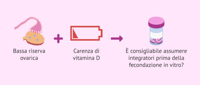 Imagen: Integrazione di vitamina D in pazienti con bassa riserva ovarica e carenza