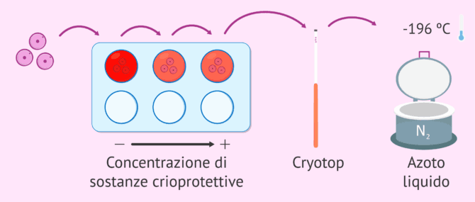 Imagen: Vitrificazione degli ovuli